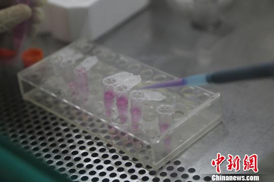 中國(guó)科學(xué)家首創(chuàng)I型糖尿病全新治療性DNA疫苗