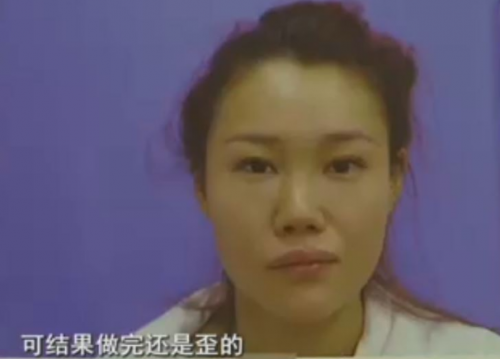 杭州格萊美整形醫(yī)院把美女鼻子成了S型 只敢開美顏拍照-易網(wǎng)健康<a href=http://www.jjkd2019.cn/jkys/ target=_blank class=infotextkey>養(yǎng)生</a>網(wǎng) 杭州格萊美整形醫(yī)院把美女鼻子成了S型 只敢開美顏拍照