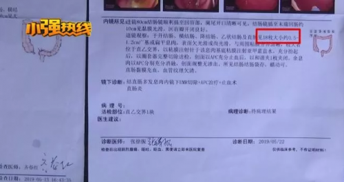 杭州醫(yī)博肛泰醫(yī)院檢查報(bào)告單與醫(yī)生描述有出入？是1顆息肉還是18顆息肉？
