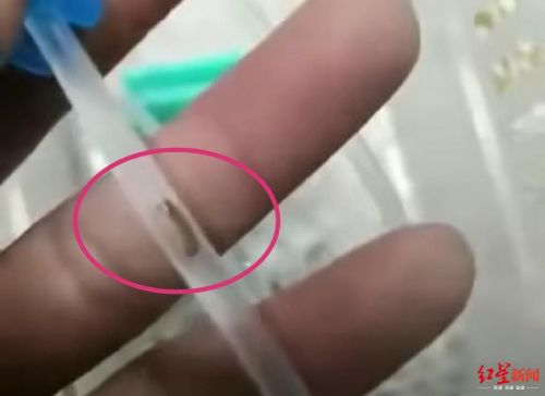 輸液管疑似有蟲(chóng) 涉事廠家河南曙光健士曾因違法生產(chǎn)醫(yī)療器械3次被罰