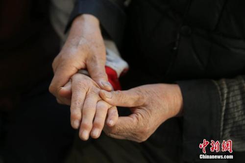 吸煙、肥胖…這也是老年癡呆的危險因素!-易網<a href=http://www.jjkd2019.cn/ target=_blank class=infotextkey>健康養生</a>網 吸煙、肥胖…這也是老年癡呆的危險因素!