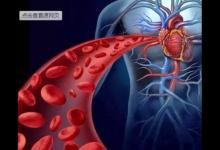 心血管科主任：5種行為最易讓血管老化，教您1招讓血管返老還童