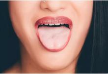 身體好不好，看舌頭就知道！