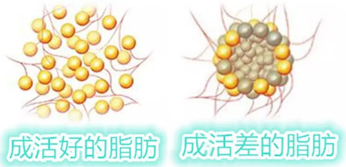 脂肪會不會轉(zhuǎn)化為糖 脂肪的消耗方法