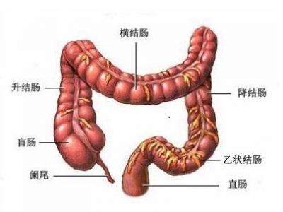 潰瘍性結腸炎患者飲食需要注意哪些方面