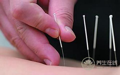 找準針灸減肥五大穴位 塑造纖細身姿-易網(wǎng)健康<a href=http://www.jjkd2019.cn/jkys/ target=_blank class=infotextkey>養(yǎng)生</a>網(wǎng) 找準針灸減肥五大穴位 塑造纖細身姿