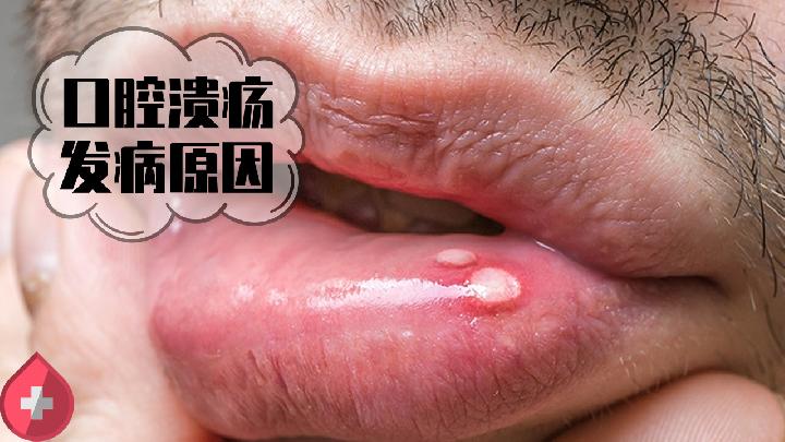 網傳的減肥偏方有效嗎?告訴你真相-易網健康<a href=http://www.jjkd2019.cn/jkys/ target=_blank class=infotextkey>養生</a>網 網傳的減肥偏方有效嗎?告訴你真相