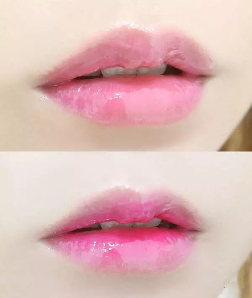  嘟嘴賣萌?麻煩先把唇部保養(yǎng)好再說 