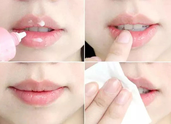  嘟嘴賣萌?麻煩先把唇部保養(yǎng)好再說 
