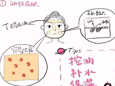 你是干性還是油性肌膚，膚質(zhì)不同護(hù)膚措施也不同