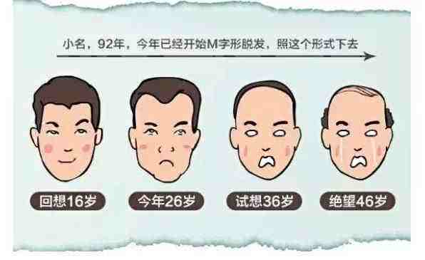 沒有家族脫發史 我為什么年紀輕輕也禿了-易網<a href=http://www.jjkd2019.cn/ target=_blank class=infotextkey>健康養生</a>網 沒有家族脫發史 我為什么年紀輕輕也禿了