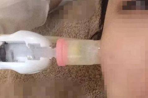 微針和水光針有什么區(qū)別?哪個治療效果會更好-易網(wǎng)健康<a href=http://www.jjkd2019.cn/jkys/ target=_blank class=infotextkey>養(yǎng)生</a>網(wǎng) 微針和水光針有什么區(qū)別?哪個治療效果會更好