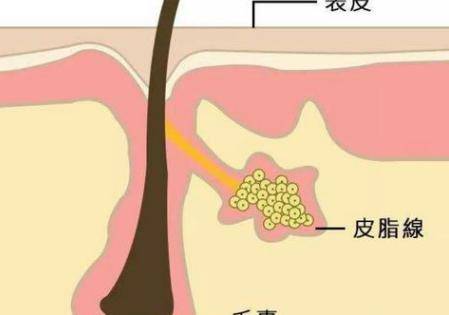 混合性皮膚痘肌T區(qū)總脫妝出油 選對粉底液很重要-易網(wǎng)<a href=http://www.jjkd2019.cn/ target=_blank class=infotextkey>健康養(yǎng)生</a>網(wǎng) 混合性皮膚痘肌T區(qū)總脫妝出油 選對粉底液很重要