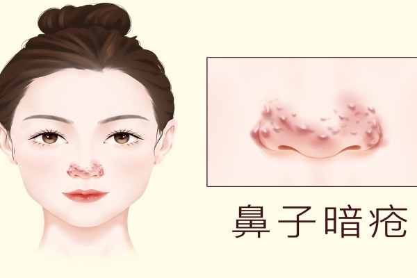 臉色暗沉發黑怎么才能變白