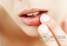 預(yù)防秋季爛嘴角的方法有哪些