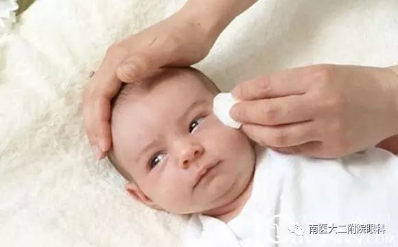 先天性淚道阻塞如何進(jìn)行按摩? 先天性淚道阻塞如何進(jìn)行按摩?