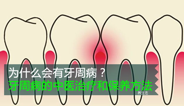 為什么會有牙周?。垦乐懿〉闹嗅t治療和保養方法