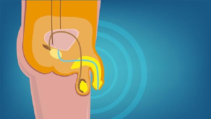 男性陰囊濕疹怎么用針灸治療 男性陰囊濕疹的針灸治療方法
