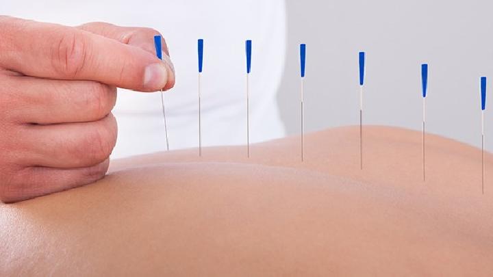確診大腸癌的10個癥狀表現(xiàn) 8個大腸癌的針灸療法介紹