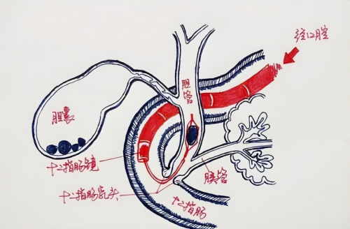十一代中醫(yī)于海燕：探秘壯血藥酒與中醫(yī)智慧，守護(hù)健康之道